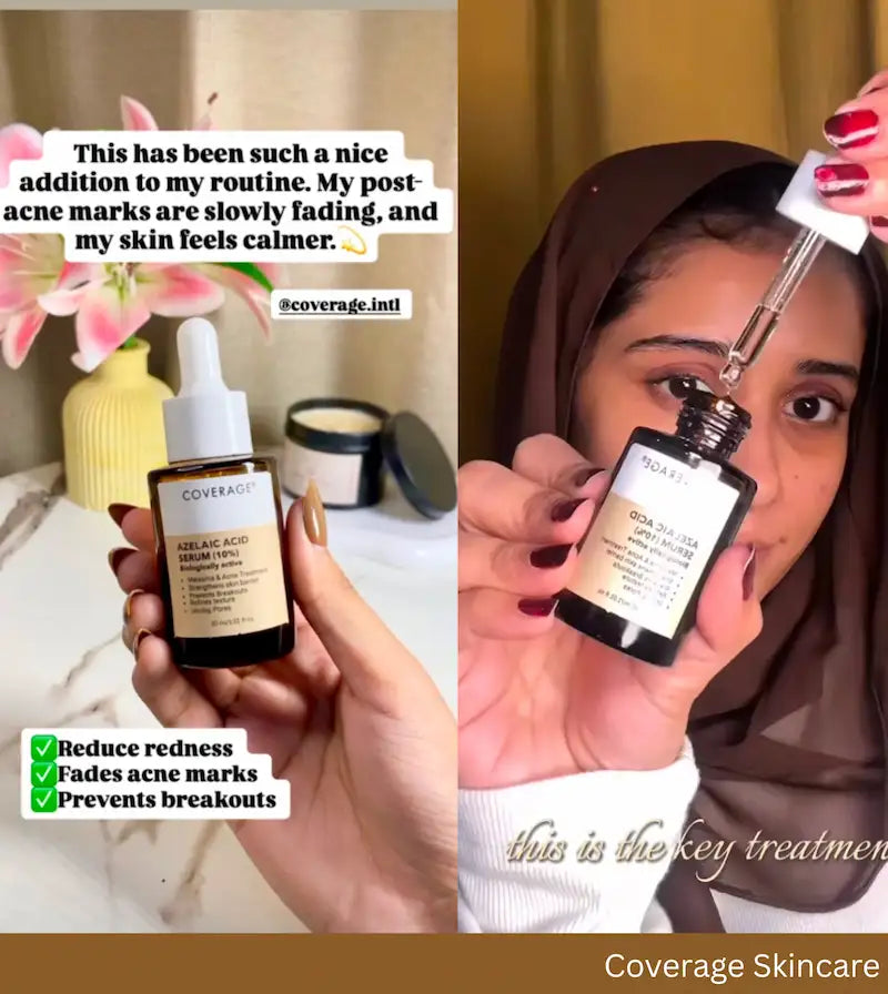 COVERAGE Azelaic Acid 10% Serum customer reviews, reduces redness and fades acne marks