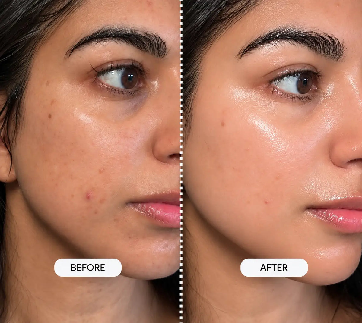 Coverage Rice & Milk Toner before and after showing intensely hydrated, plump and glowing glass-like skin