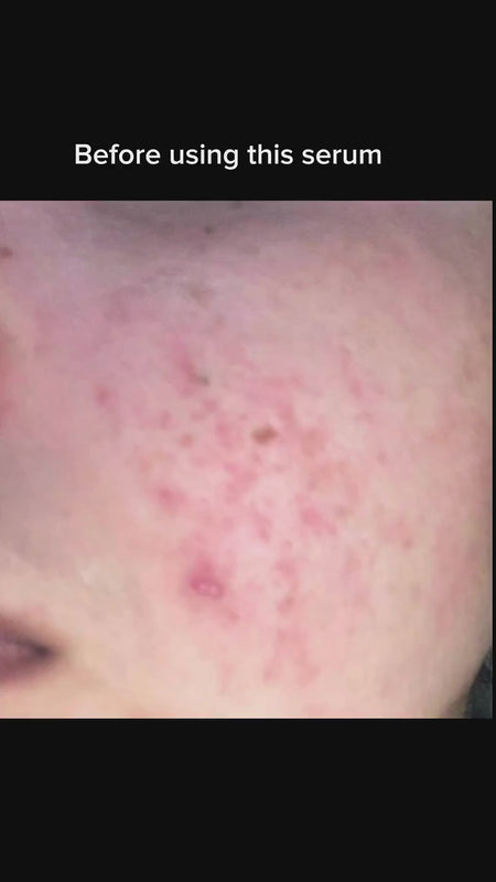 COVERAGE Skincare customer video