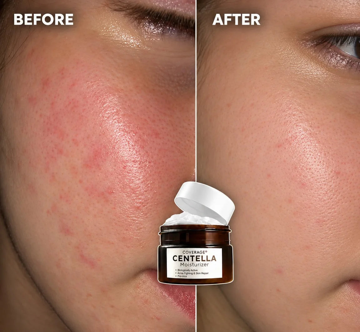 COVERAGE SKINCARE Centella Moisturizer 60ml - barrier repair cream with ceramide and niacinamide for sensitive skin in Pakistan
